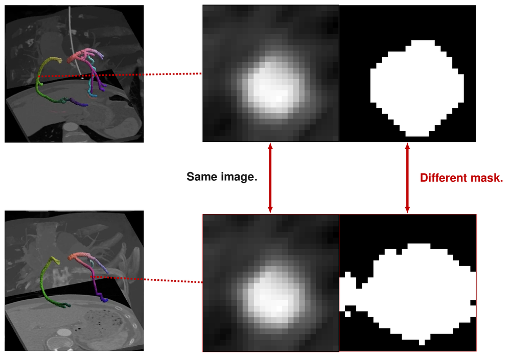 Two near-identical cross-sections whose masks disagree; hovering walks a coronary centreline